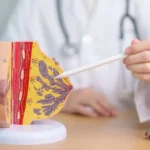 Mastitis, Stillprobleme, Entzündung, Stillberatung, Steffi Weiss, Stillen Köln