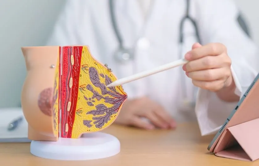 Mastitis, Stillprobleme, Entzündung, Stillberatung, Steffi Weiss, Stillen Köln